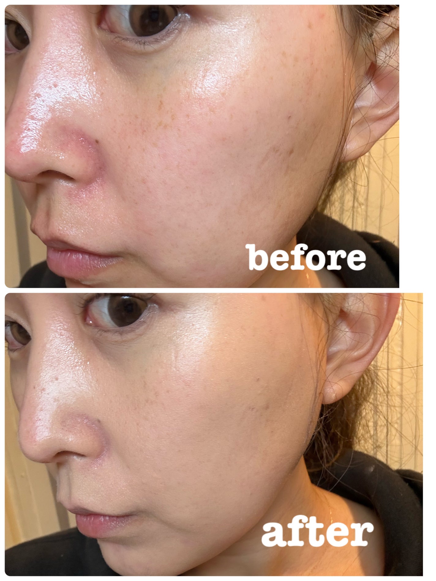 デューイーメッシュファンデーション/ASUNE /クッションファンデーションを使ったクチコミ(3枚目)