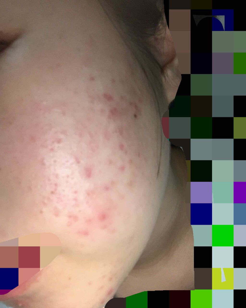 ACモイスト スキンケアトリニティー キット (2week)/iniks/スキンケアキットを使ったクチコミ(2枚目)