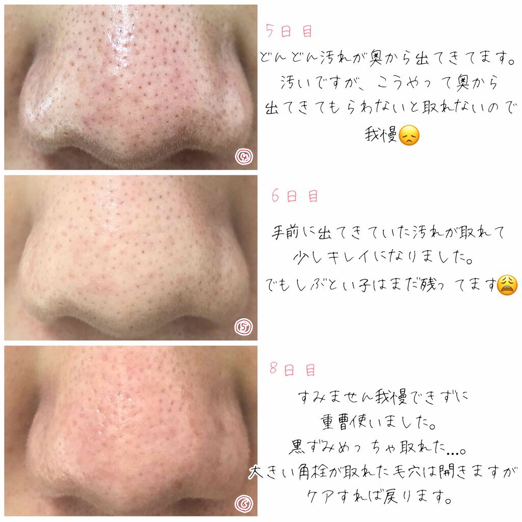 キノコ 解読する 海外で 鼻 綿棒 オイル Yumekiko Jp