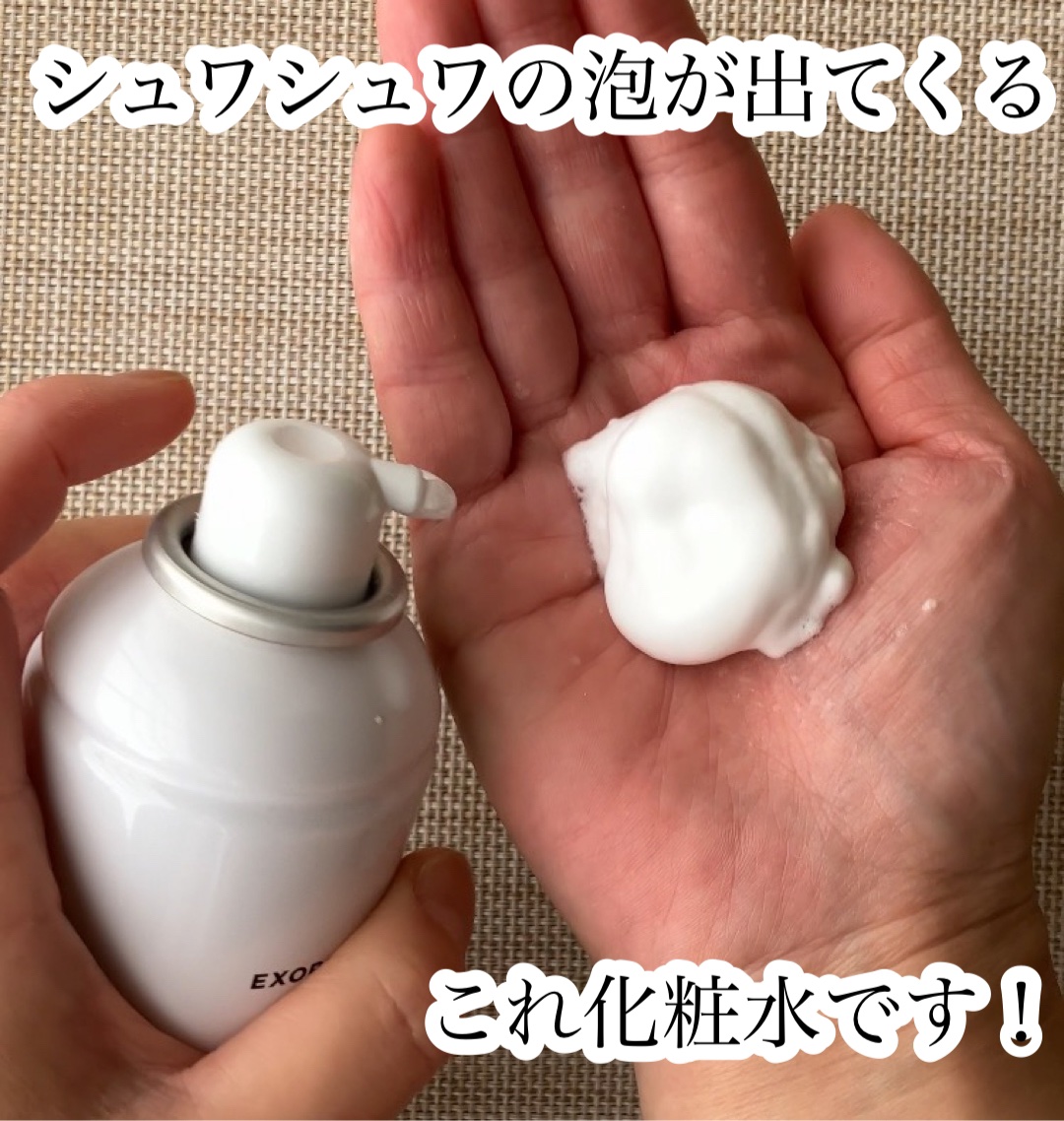 エクソリームローション/NEO COLLECTION/化粧水を使ったクチコミ（2枚目）