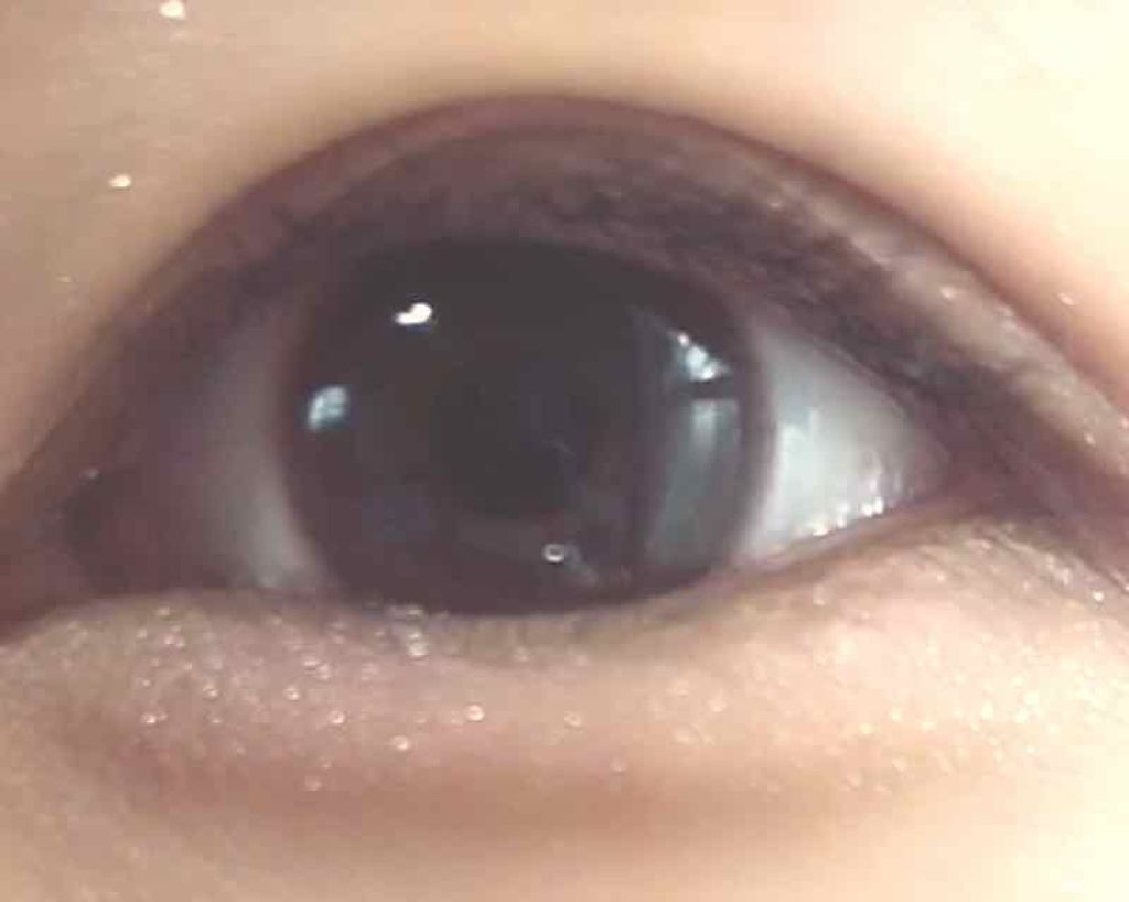 のびーるアイテープ（絆創膏タイプ、レギュラー）/DAISO/二重まぶた用アイテムを使ったクチコミ（1枚目）