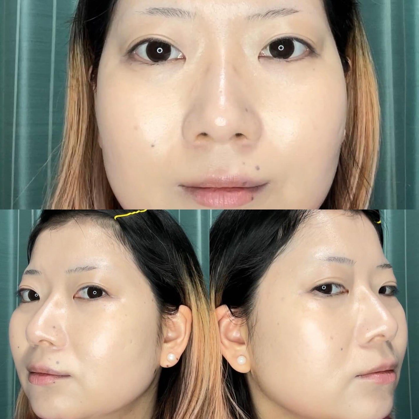 デューイーメッシュファンデーション/ASUNE /クッションファンデーションを使ったクチコミ(7枚目)