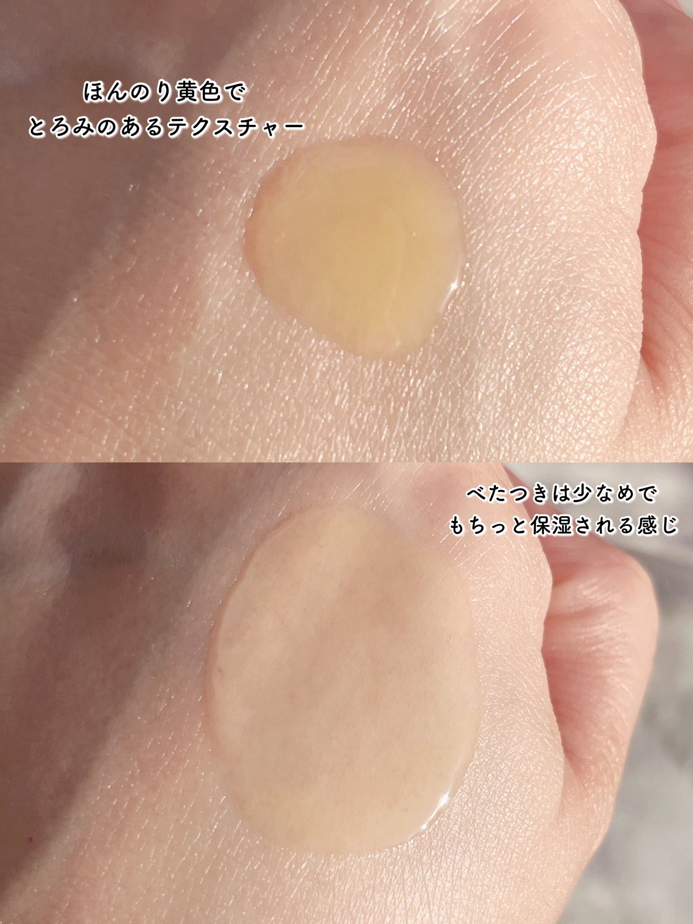 レッドアクネセラム/MEDICUBE/美容液を使ったクチコミ(3枚目)