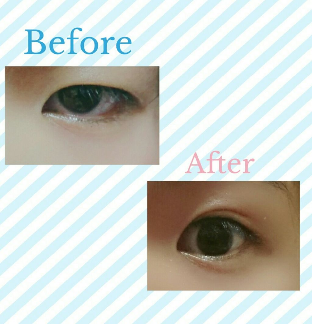 ハイブリッドフィルム/アイトーク/二重まぶた用アイテムを使ったクチコミ(2枚目)