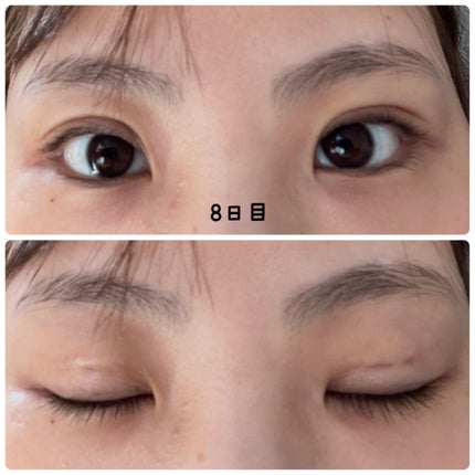 ナイトアイボーテ/StreeTrend/二重まぶた用アイテムを使ったクチコミ(8枚目)