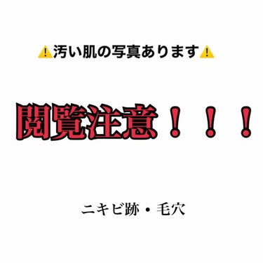 むーな on LIPS 「誰か助けてください…⚠️閲覧注意です。とっても汚いです！！前の..」（1枚目）