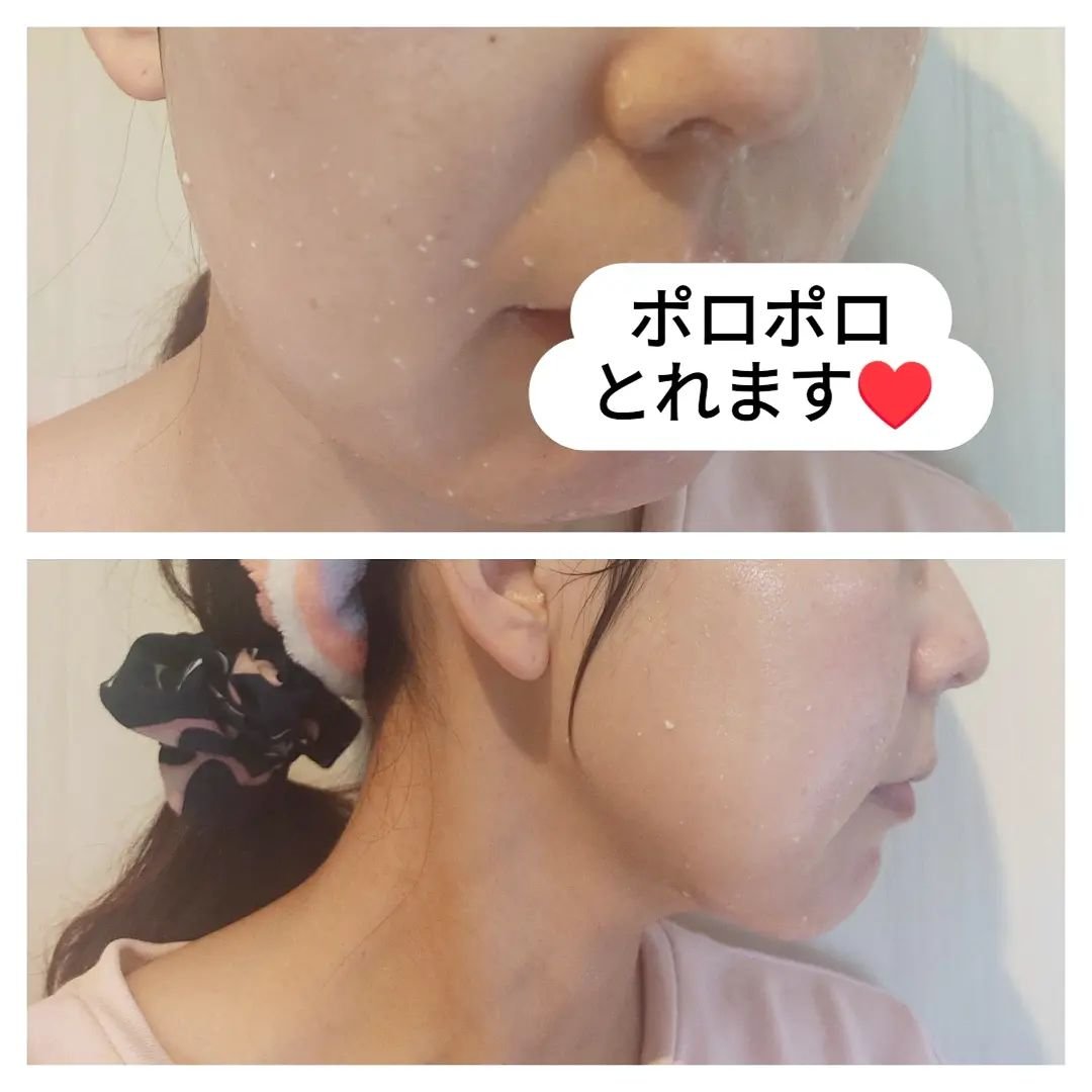 イージースムースピーリングジェルマスク /Shangpree/洗い流すパック・マスクを使ったクチコミ（3枚目）