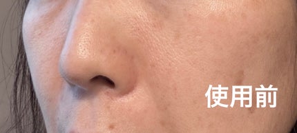 デイスキンコンフォート/excel/フェイスクリームを使ったクチコミ(5枚目)