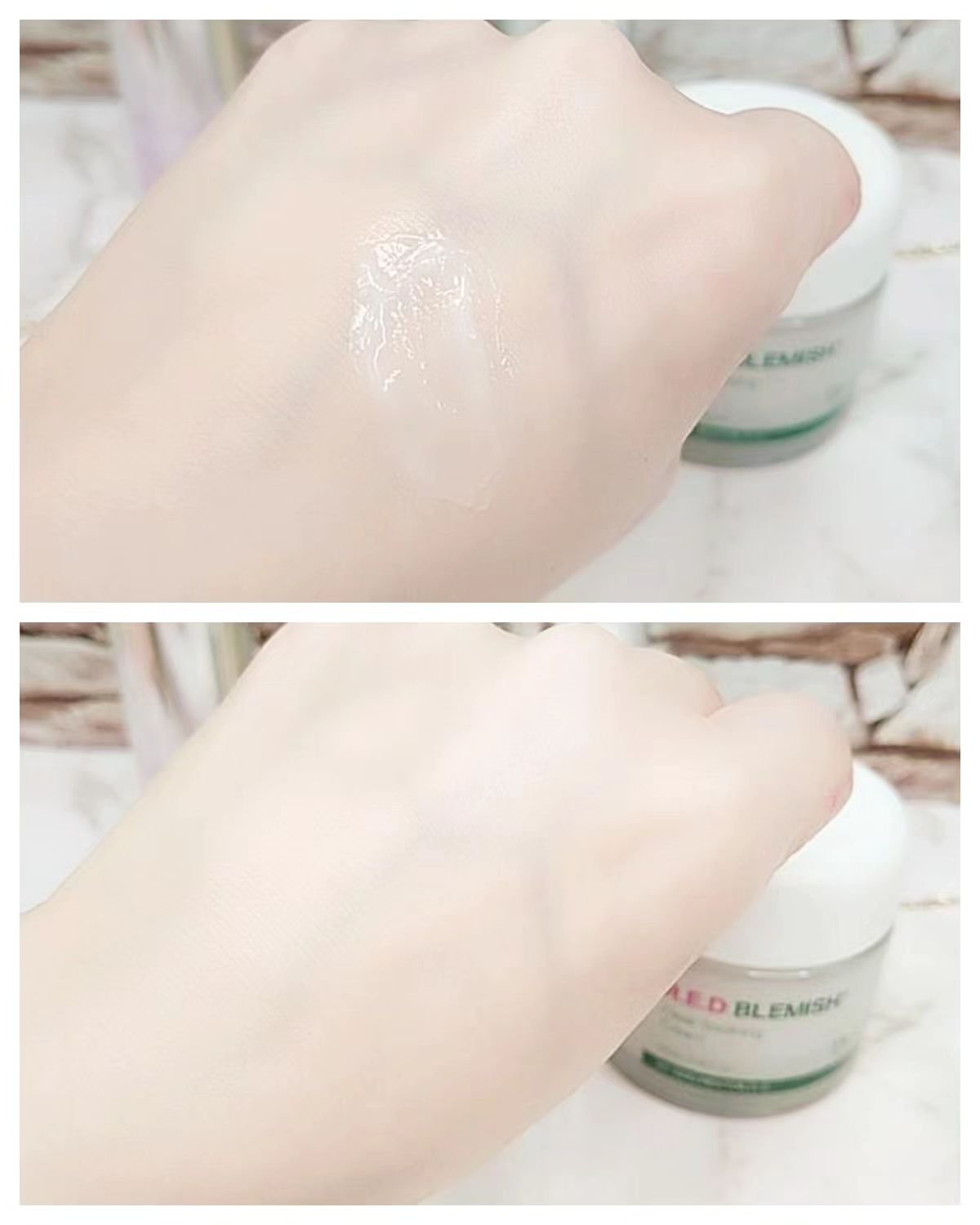 レッドブレミッシュ クリアスージングクリーム/Dr.G/フェイスクリームを使ったクチコミ（3枚目）