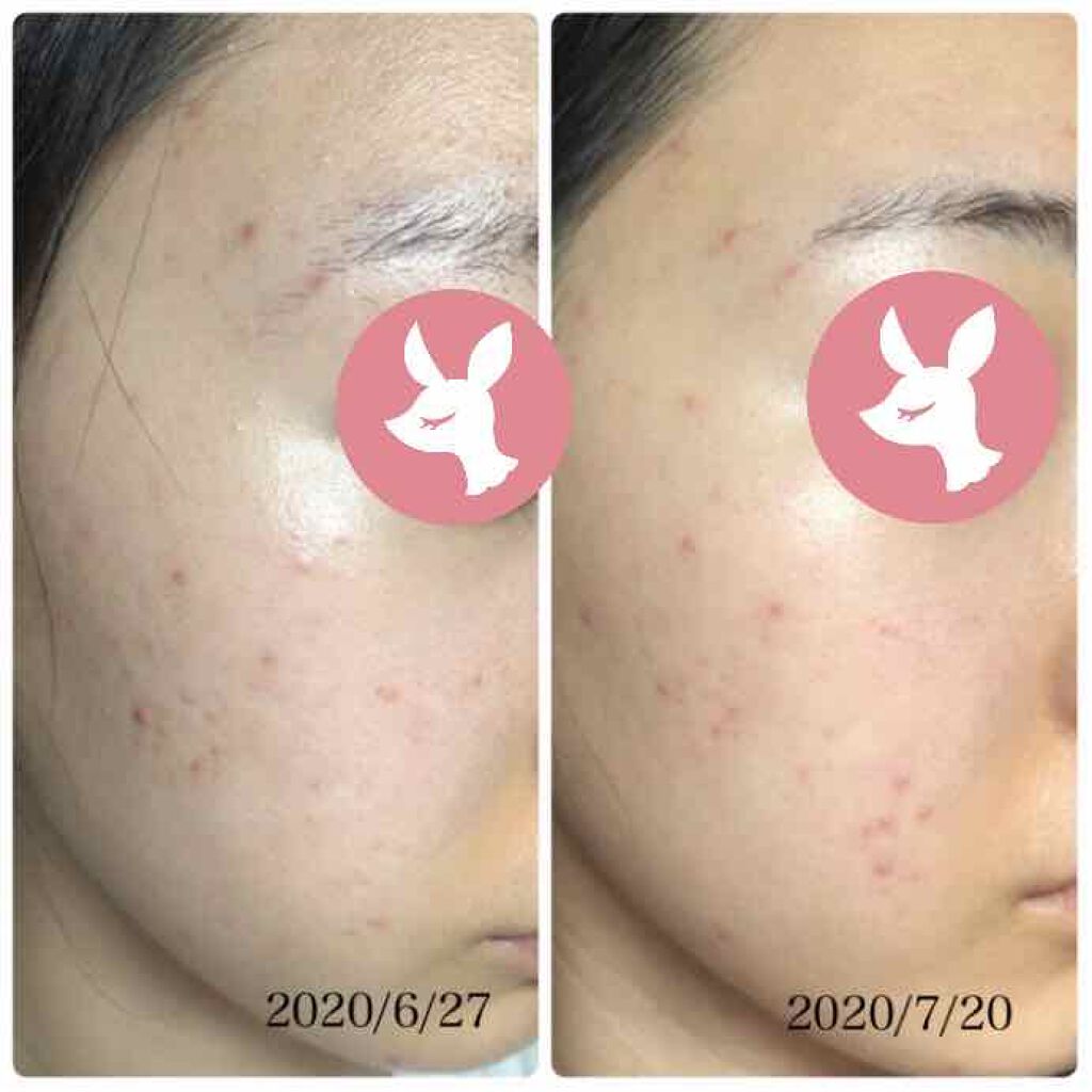 AC ウォッシングフォーム/NOV/洗顔フォームを使ったクチコミ(4枚目)