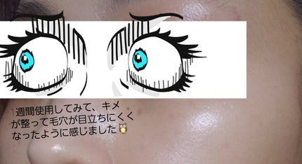 ゼロ毛穴1DAYセラム/MEDICUBE/美容液を使ったクチコミ(4枚目)