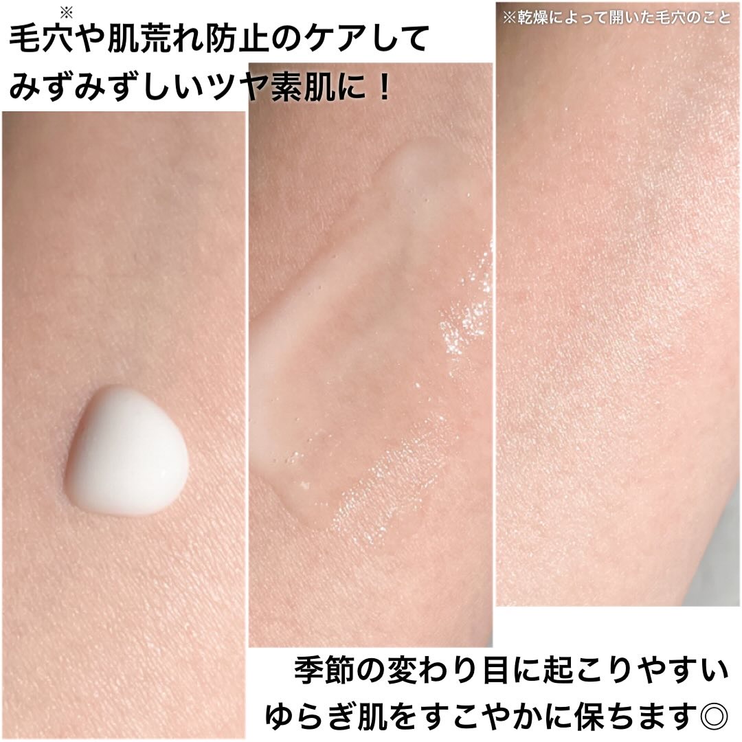 アゼペア 美容液/ネイチャーリパブリック/美容液を使ったクチコミ（3枚目）