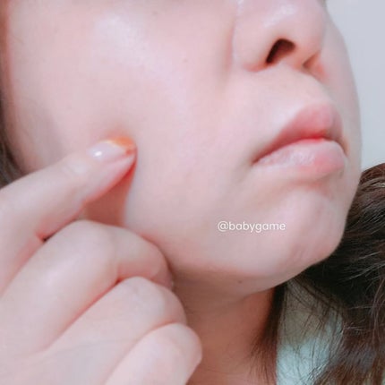 極薄透明パッチ nikipa!/金冠堂/にきびパッチを使ったクチコミ(4枚目)