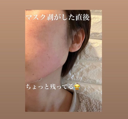 ねこむす on LIPS 「@dr.althea_japan_official様の モニタ..」(7枚目)