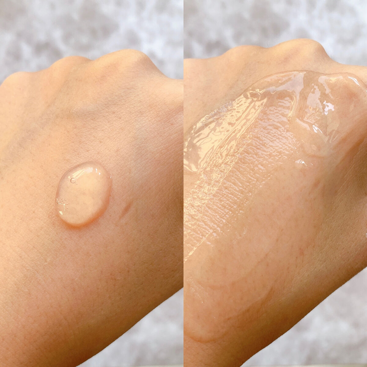 レッドブレミッシュスージングアクティブエッセンス/Dr.G/ブースター・導入液を使ったクチコミ（2枚目）