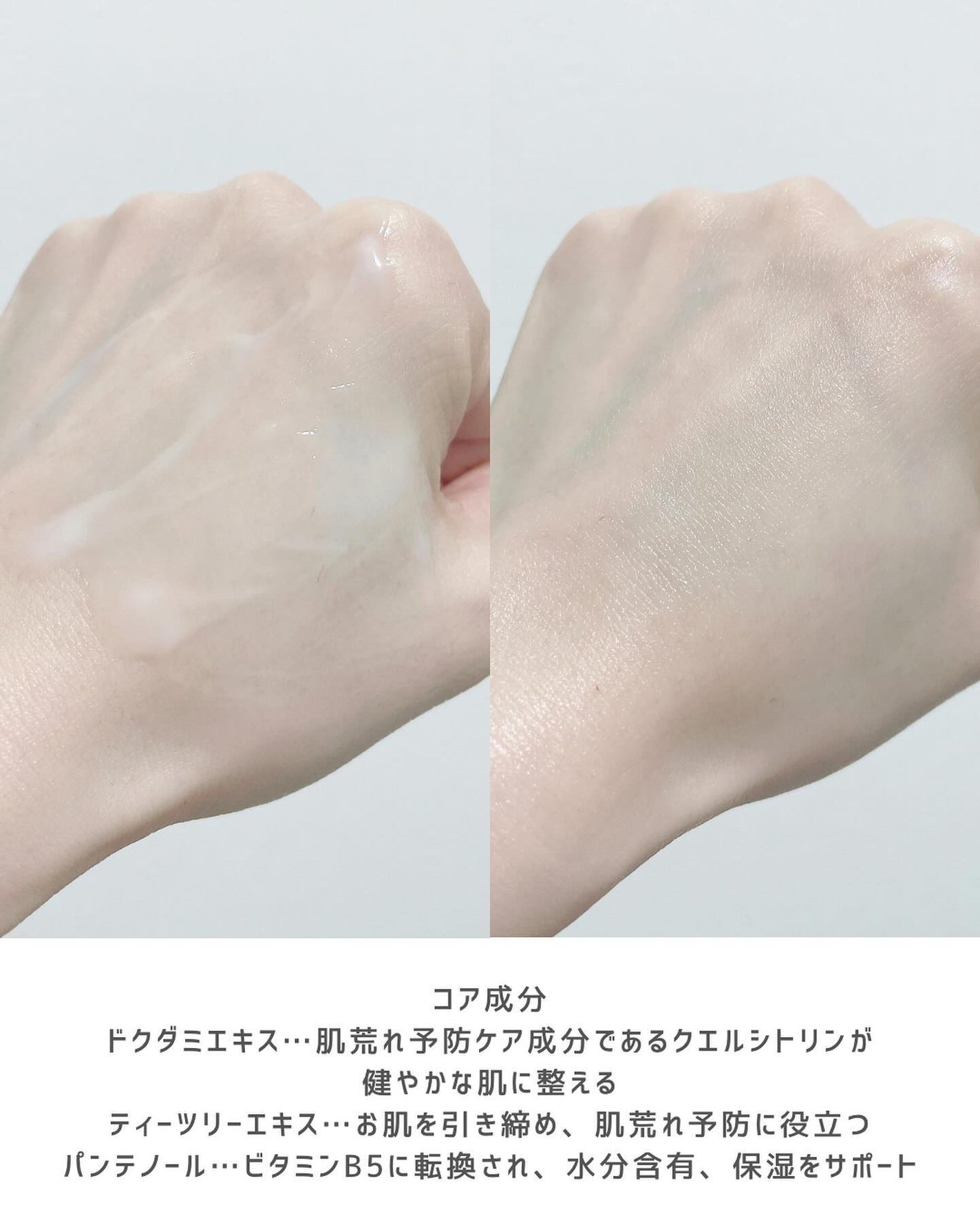 Sensitive Soothing Gel Cream/MARY&MAY/フェイスクリームを使ったクチコミ(5枚目)