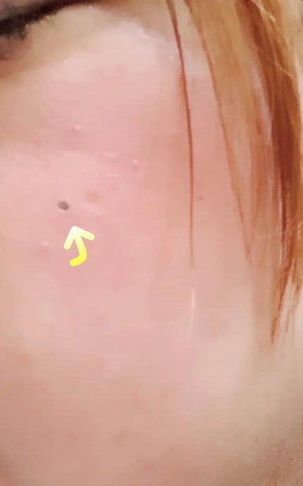 を使ったクチコミ(2枚目)