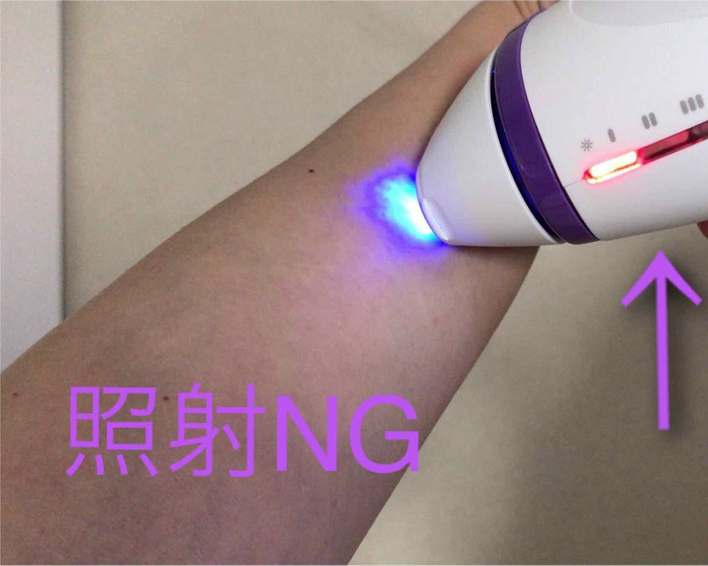 ブラウンシルクエキスパート （光美容器）/ブラウン/家庭用脱毛器を使ったクチコミ（2枚目）