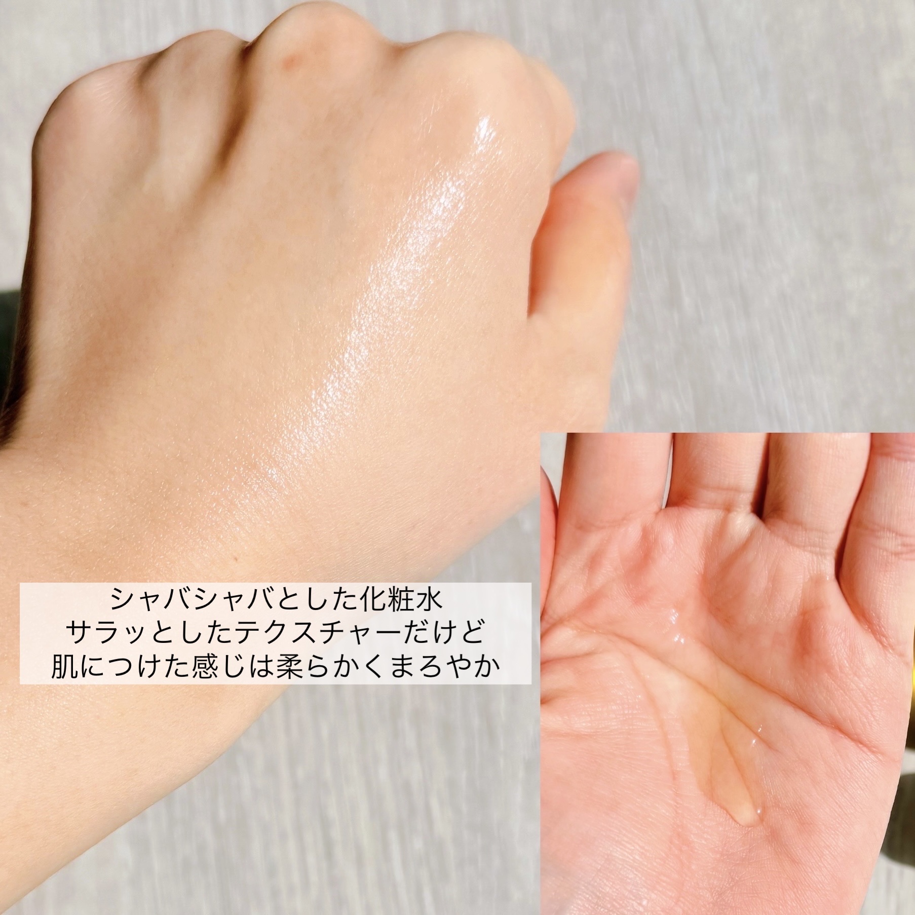 シカテロルトナー/beplain/化粧水を使ったクチコミ（3枚目）