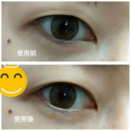 ORIPUCHI/Girl's Maker/二重まぶた用アイテムを使ったクチコミ(2枚目)