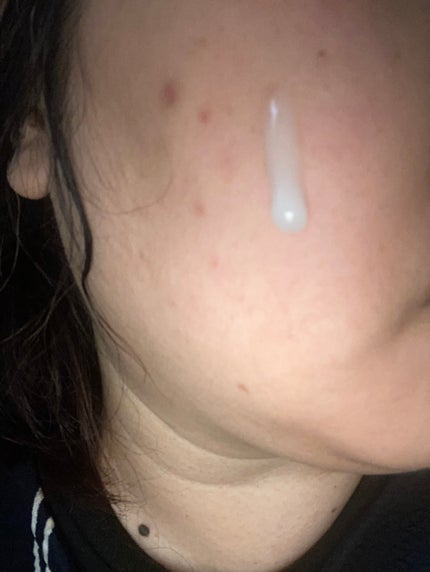 マイルドリードルショット50/VT/美容液を使ったクチコミ(3枚目)