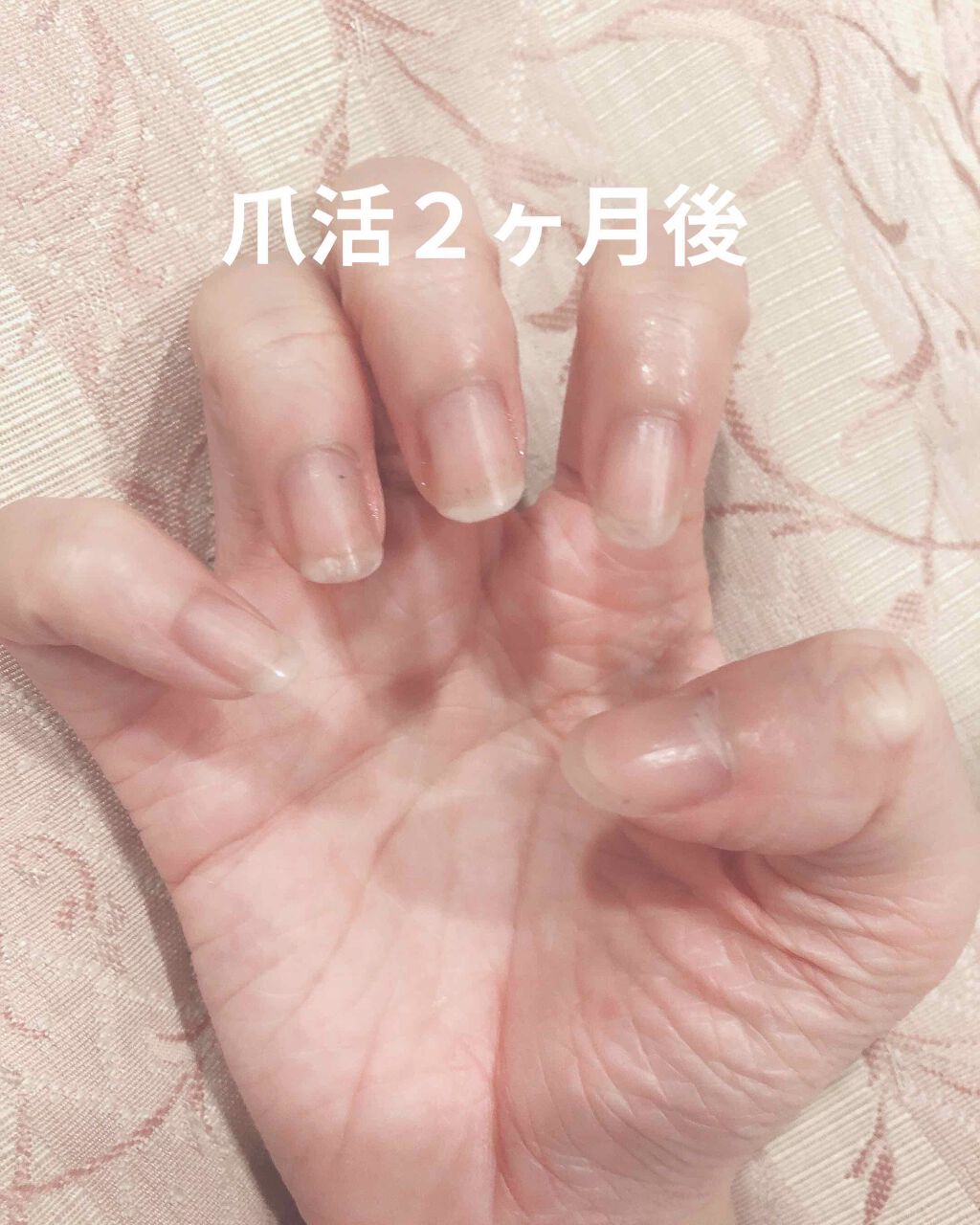 エテュセ クイックケアコート/ettusais/ネイルオイル・トリートメントを使ったクチコミ（2枚目）