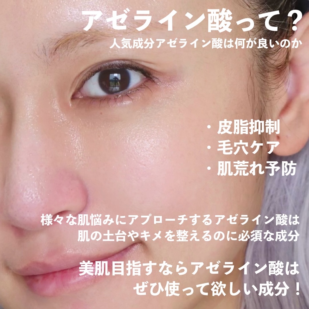 ダーマレーザー ウルセラAZ/クオリティファースト/美容液を使ったクチコミ（2枚目）