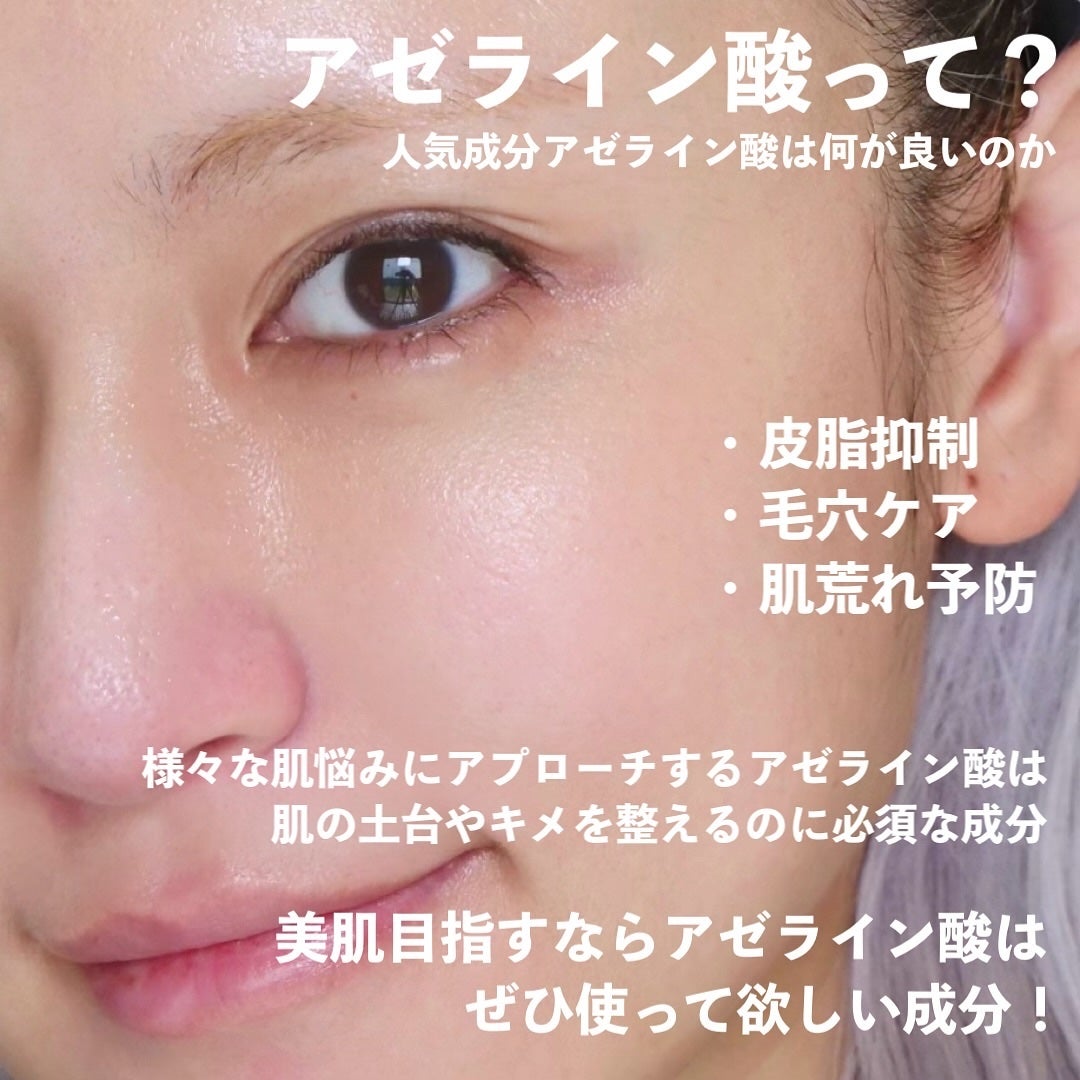 ダーマレーザー ウルセラAZ/クオリティファースト/美容液を使ったクチコミ(2枚目)