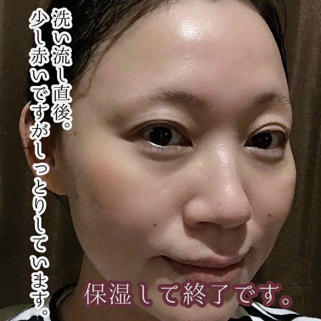 エトゥベラ ブランソーダフェイスパック フェイスパック 炭酸パック /ワールドジェイビー/洗い流すパック・マスクを使ったクチコミ(4枚目)