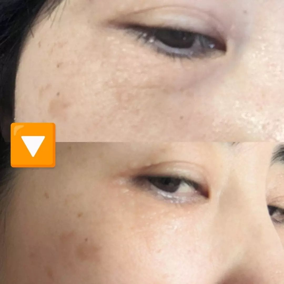 おほあんどうふ on LIPS 「面長のワタシは目元にシワができやすいんですってマスクでも隠れな..」(1枚目)