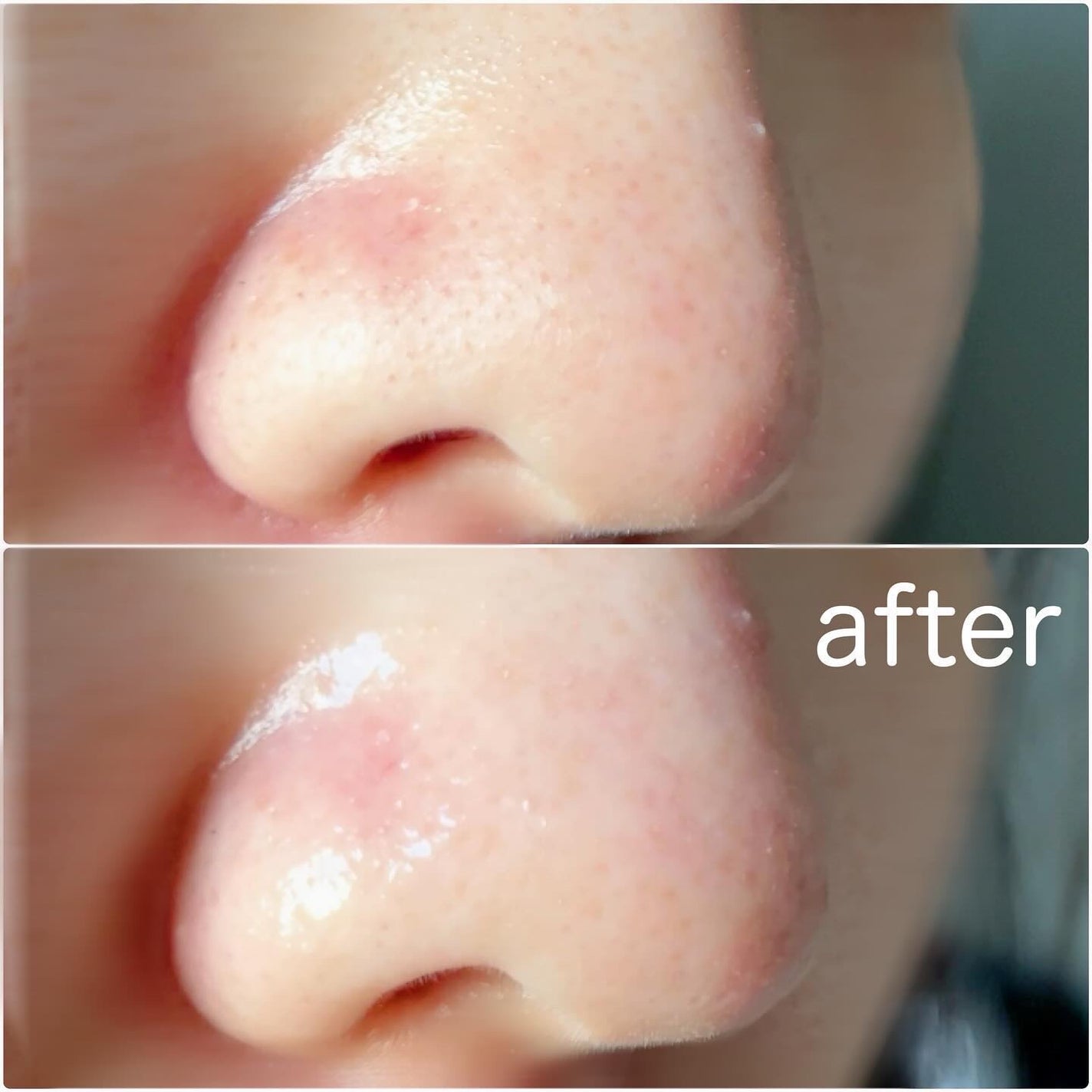 ナチュラルマイルドクリアノーズパック/ilso/シートマスク・パックを使ったクチコミ(6枚目)