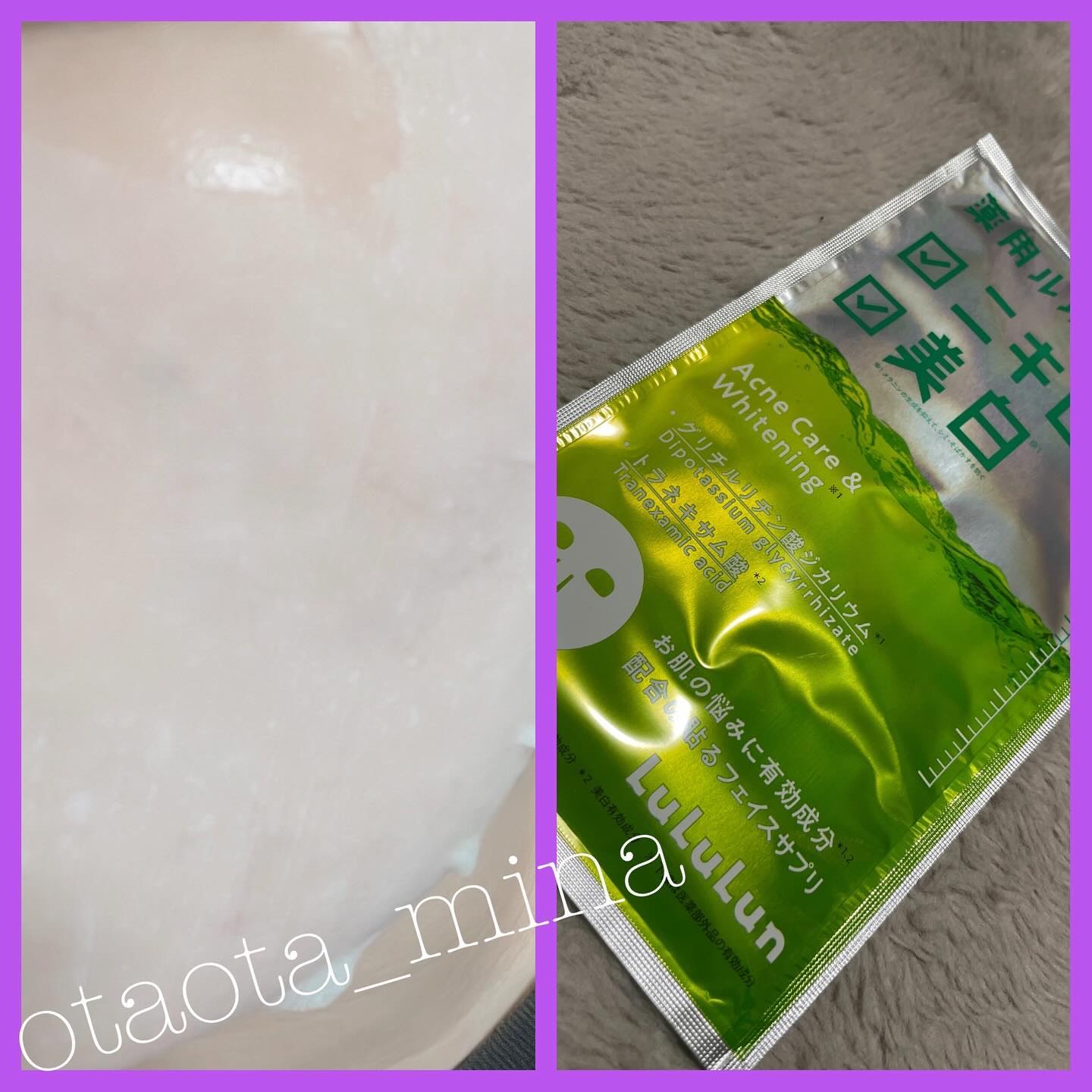 薬用ルルルン 美白アクネ/ルルルン/シートマスク・パックを使ったクチコミ（2枚目）