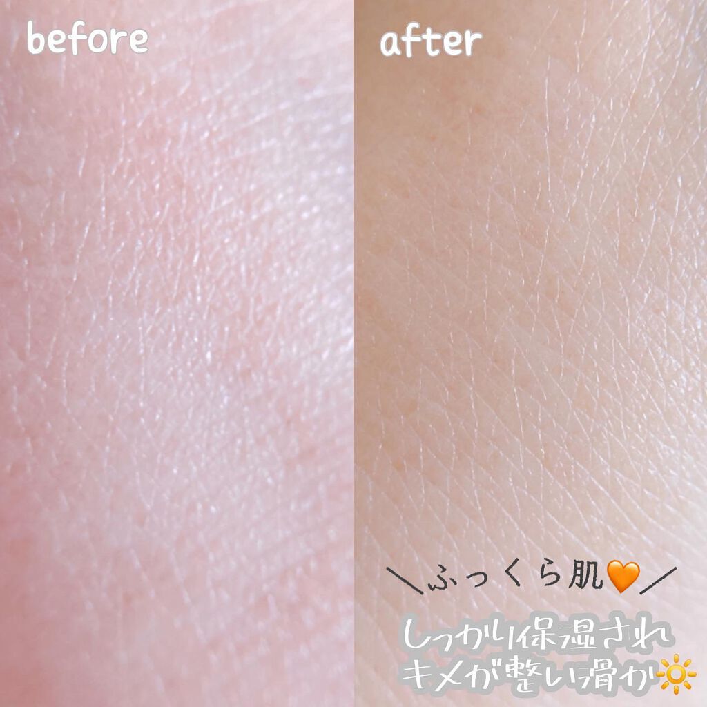 ホットスプリングセラムフェイスクリーム/ルビナス/フェイスクリームを使ったクチコミ（3枚目）