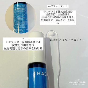 アクネキュアクリーム(医薬品)/IHADA/その他を使ったクチコミ（2枚目）