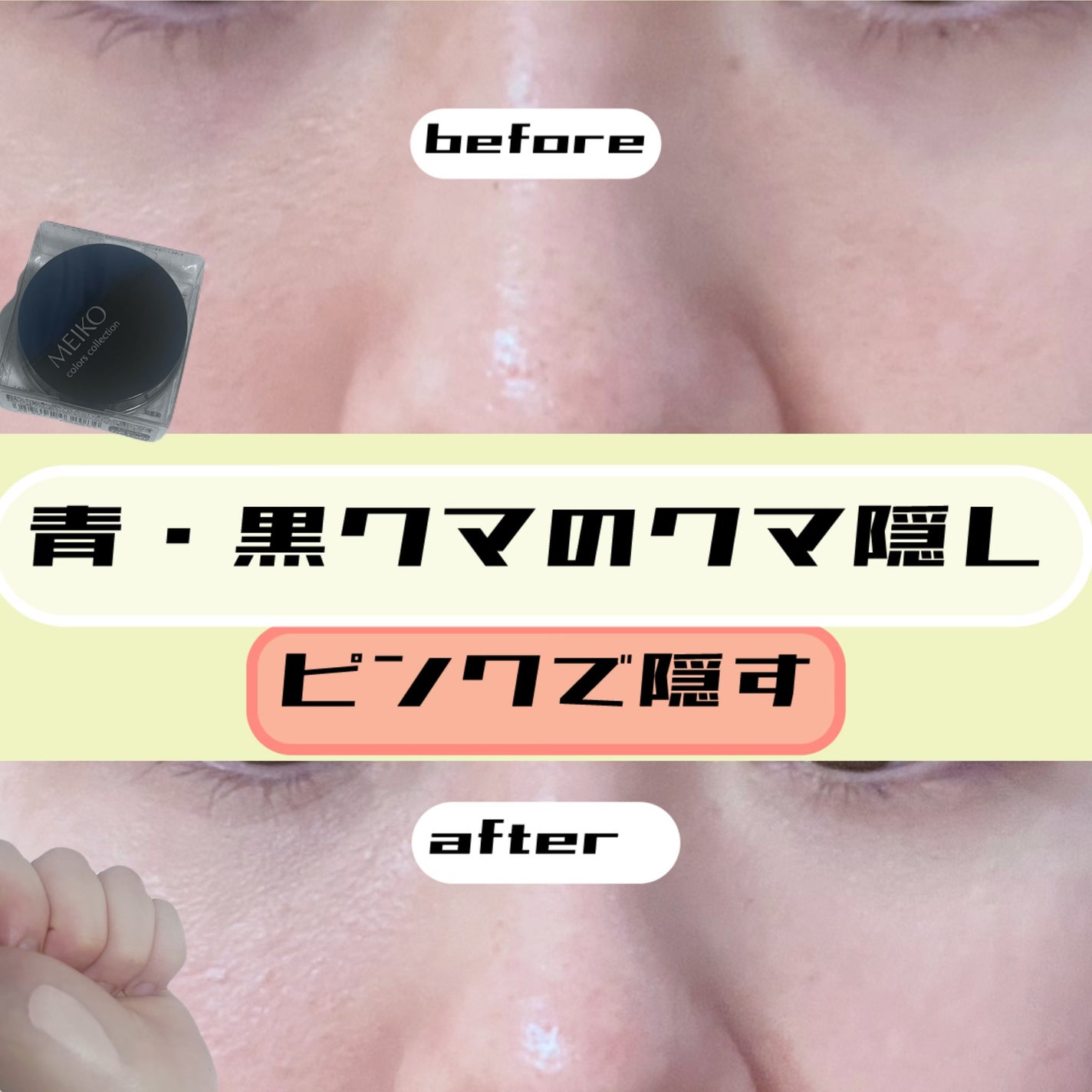 MCコレクション カバーフェイス(コンシーラー)/メイコー化粧品/クリームコンシーラーを使ったクチコミ(1枚目)