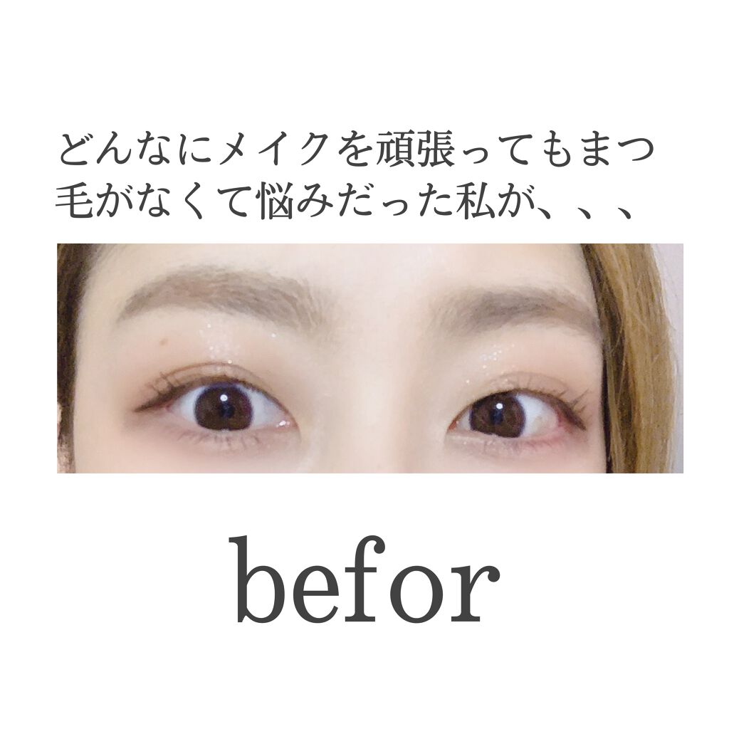 グラッシュビスタ/グラッシュビスタ/まつげ美容液を使ったクチコミ（3枚目）