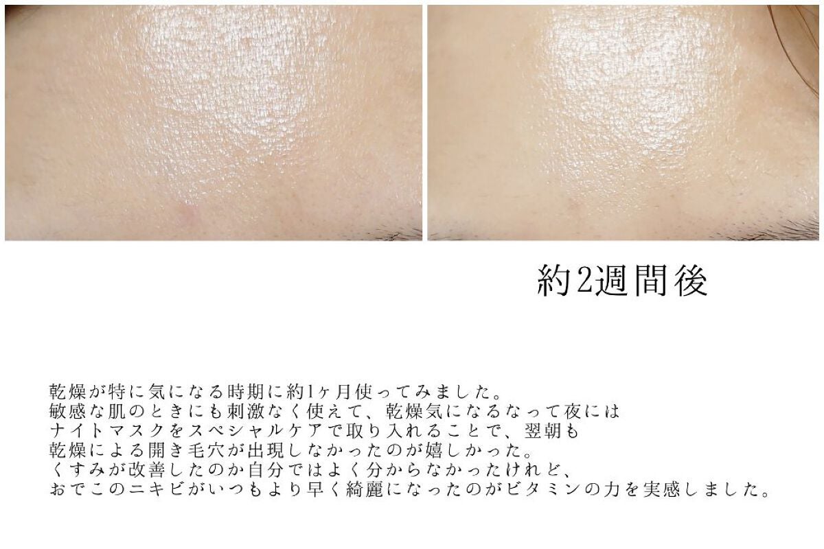 シカバイタル エッセンス/VT/美容液を使ったクチコミ(6枚目)