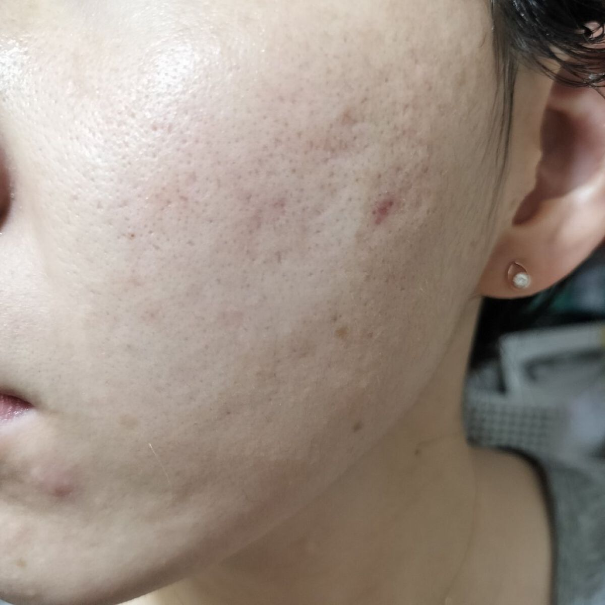 LA10+HAフェイスセラム/The Ordinary/ピーリングを使ったクチコミ（2枚目）