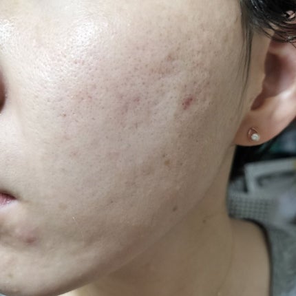 LA10+HAフェイスセラム/The Ordinary/ピーリングを使ったクチコミ(2枚目)