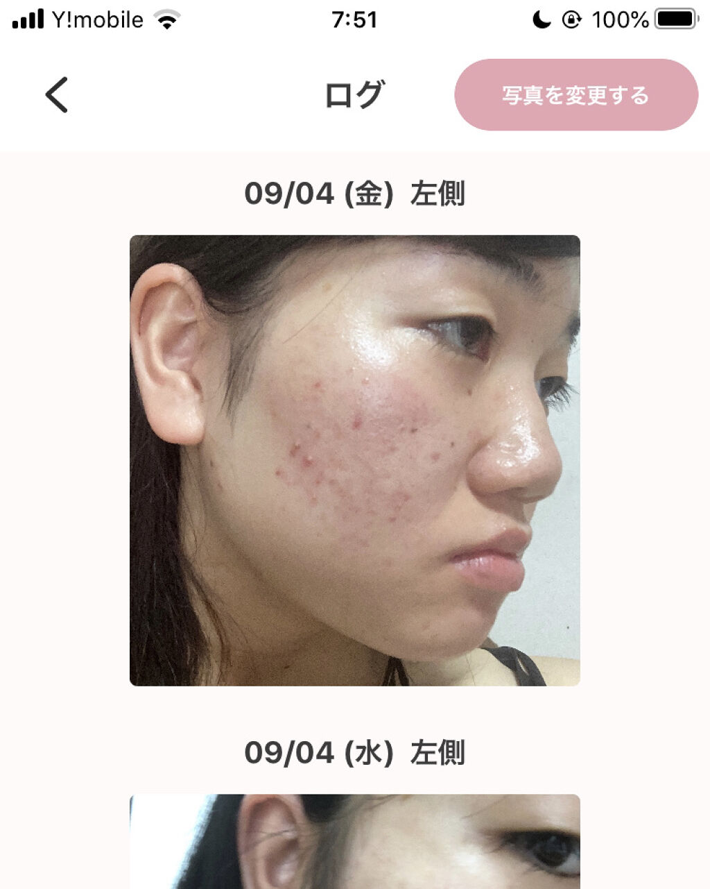 を使ったクチコミ（2枚目）