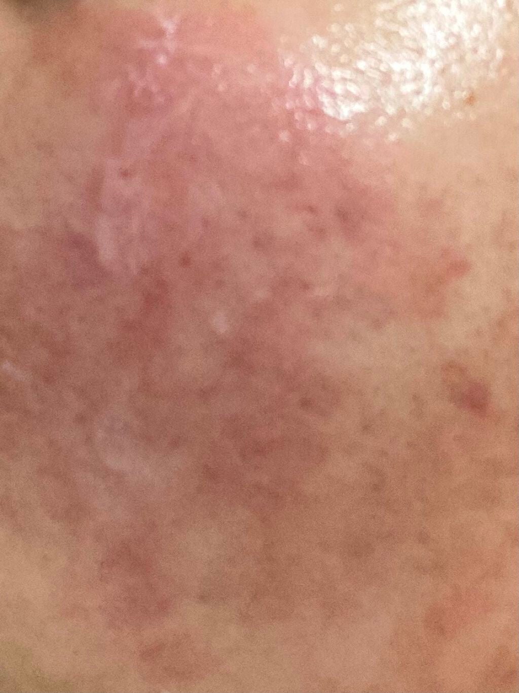 chiyuri on LIPS 「大変なことが起きたのでちょっと共有させてください!!!(ストレ..」(2枚目)