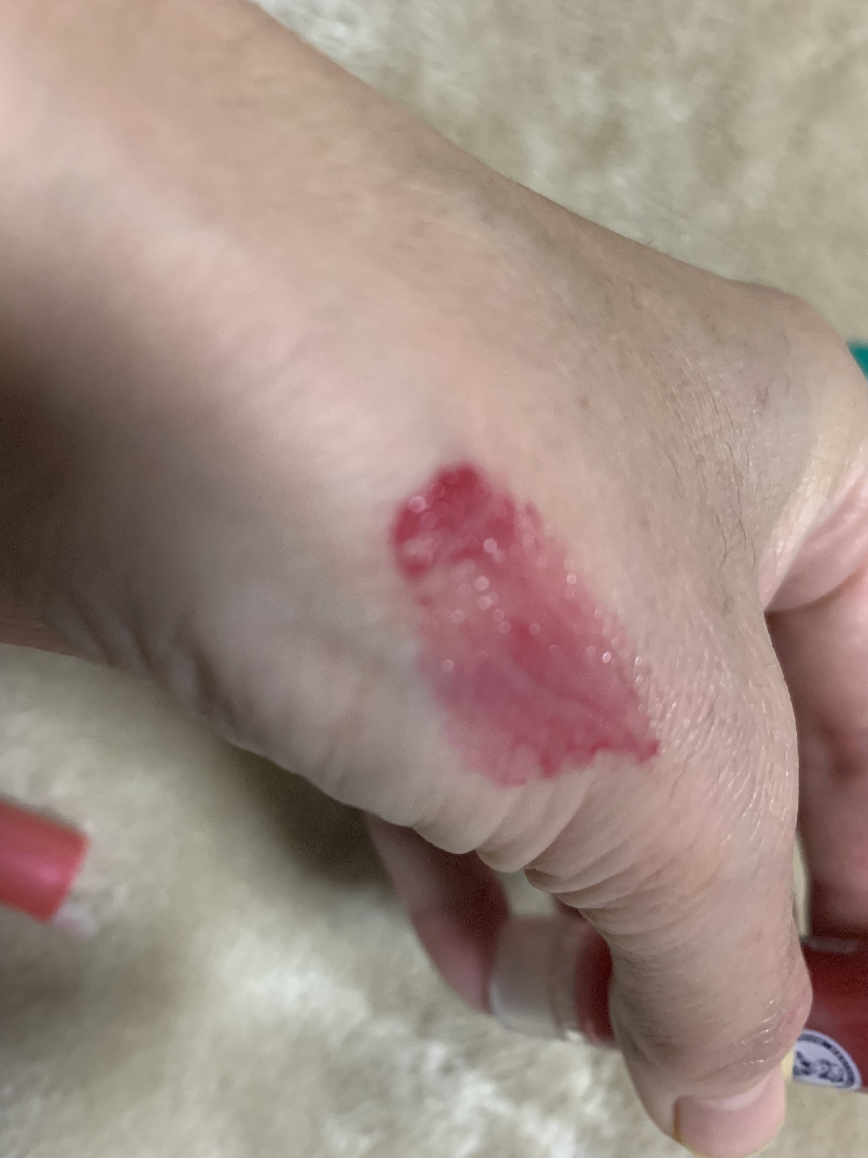 メンソレータム リップフォンデュ/メンソレータム/リッププランパーを使ったクチコミ（3枚目）