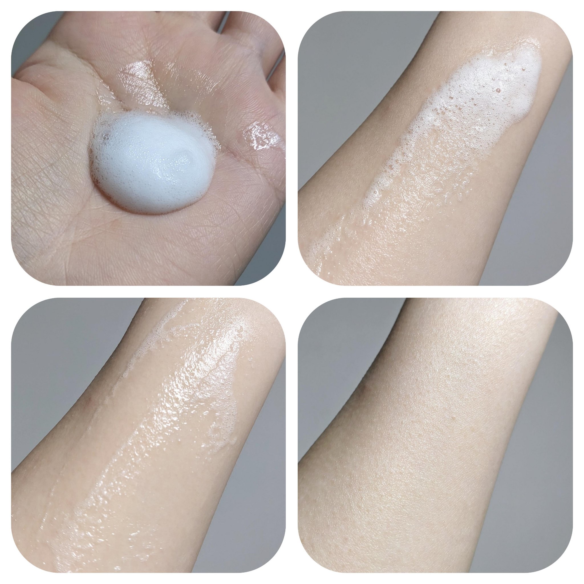 フェルゼアプレミアム 薬用泡の化粧水/フェルゼア/化粧水を使ったクチコミ（2枚目）