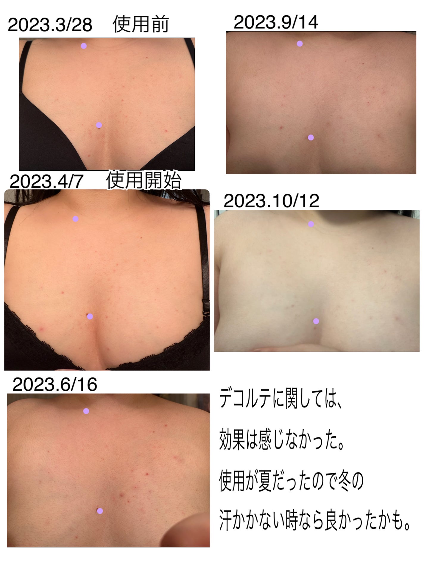 レッドブレミッシュスージングボディウォッシュ/Dr.G/ボディソープを使ったクチコミ(5枚目)