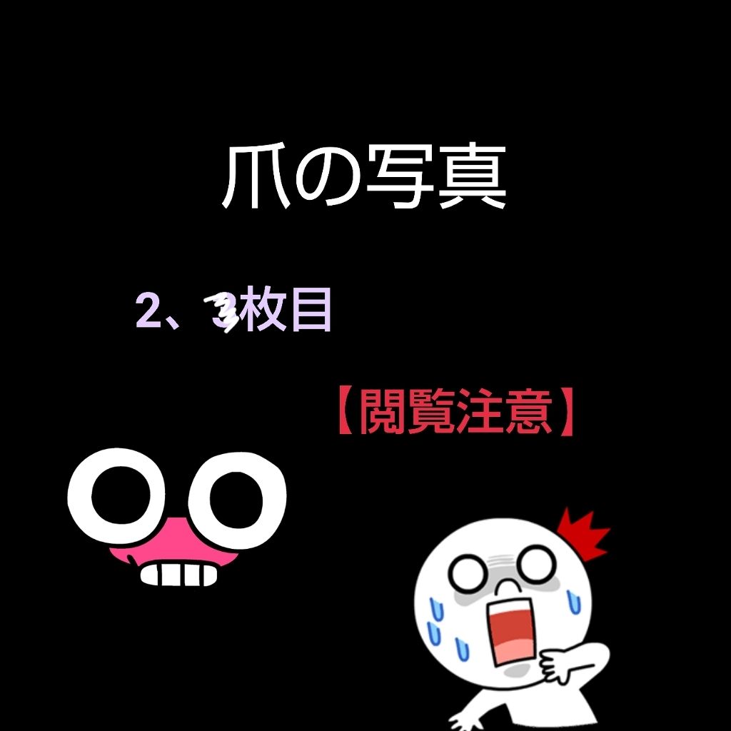 ネイルオイル/セリア/ネイルオイル・トリートメントを使ったクチコミ（1枚目）