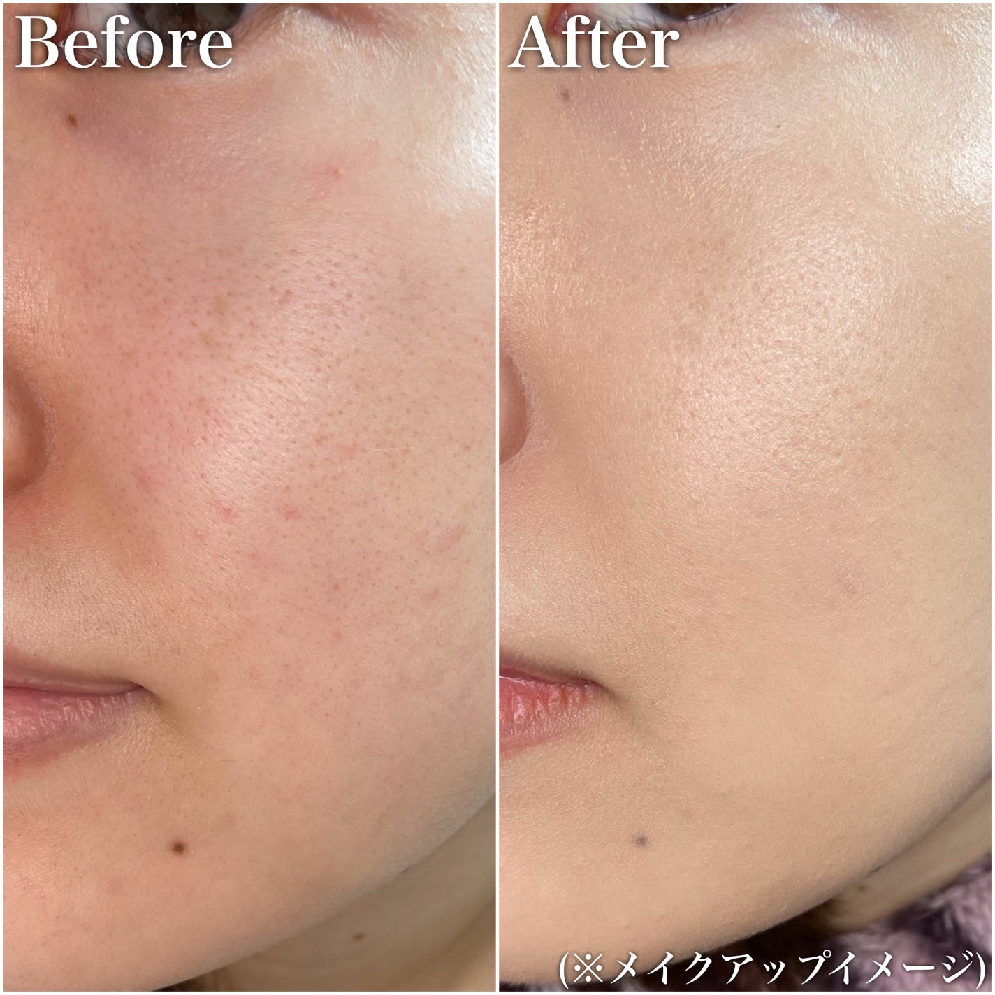 SIGNATURE ESSENCE COVER PACT /AGE20’s/クリーム・エマルジョンファンデーションを使ったクチコミ(5枚目)