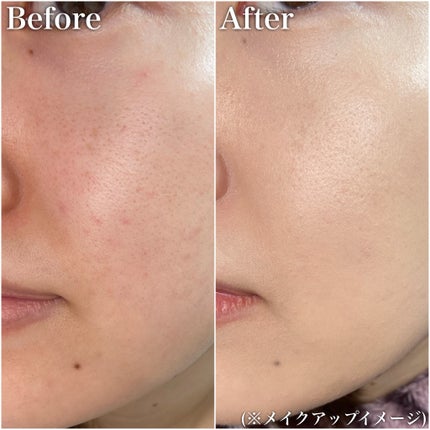 SIGNATURE ESSENCE COVER PACT /AGE20’s/クリーム・エマルジョンファンデーションを使ったクチコミ(5枚目)