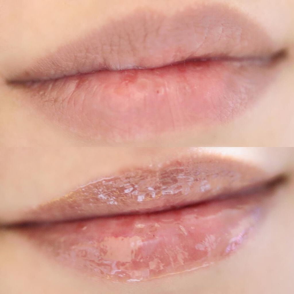 を使ったクチコミ（1枚目）