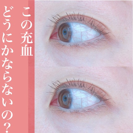 ロートリセ(医薬品)/ロート製薬/その他を使ったクチコミ(1枚目)