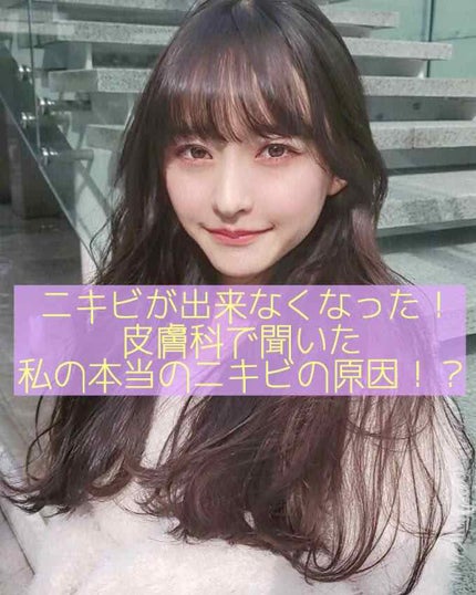 ノブ A アクネソープ/NOV/洗顔石鹸を使ったクチコミ(1枚目)